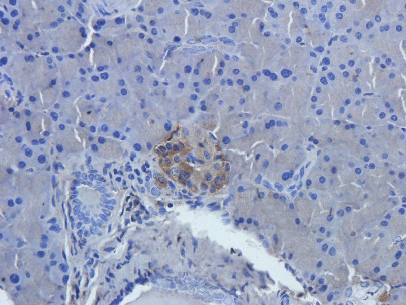 TGF beta Receptor 2 Rabbit Polyclonal Antibody