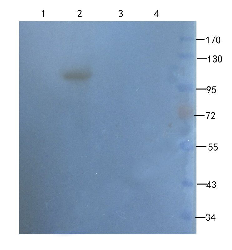 TGF beta Receptor 2 Rabbit Polyclonal Antibody