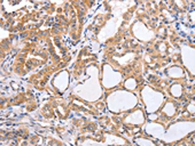TGFA Antibody