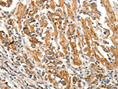 TGFBR1 Antibody