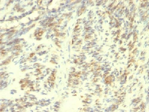 TGM2 Antibody