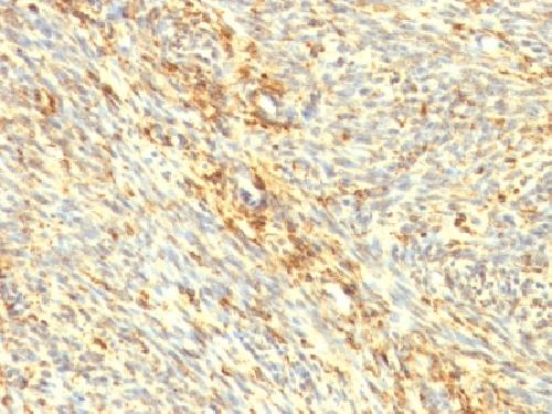 TGM2 Antibody