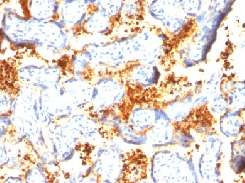 TGM2 Antibody