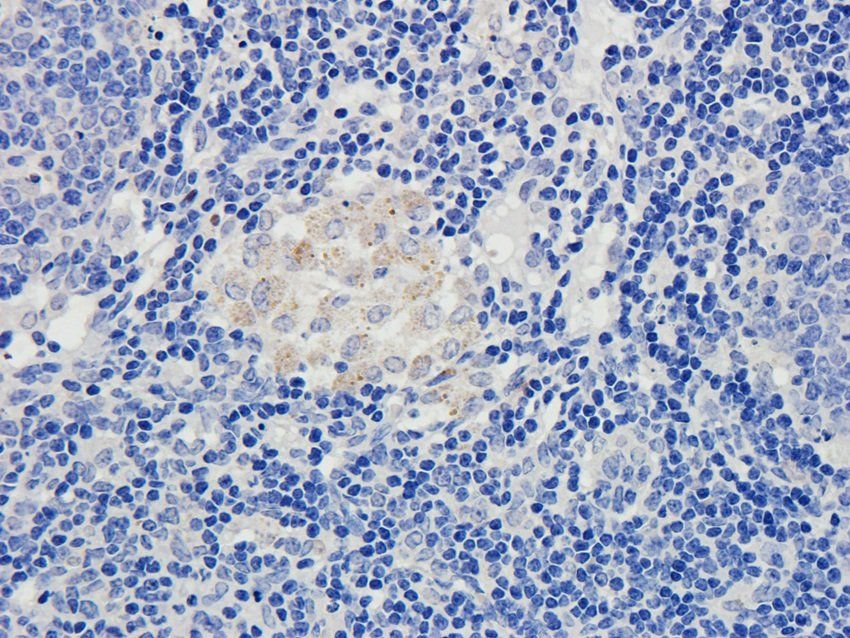 TGN46 Rabbit Polyclonal Antibody