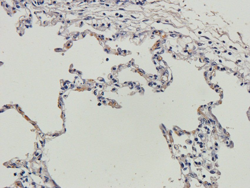 TGN46 Rabbit Polyclonal Antibody