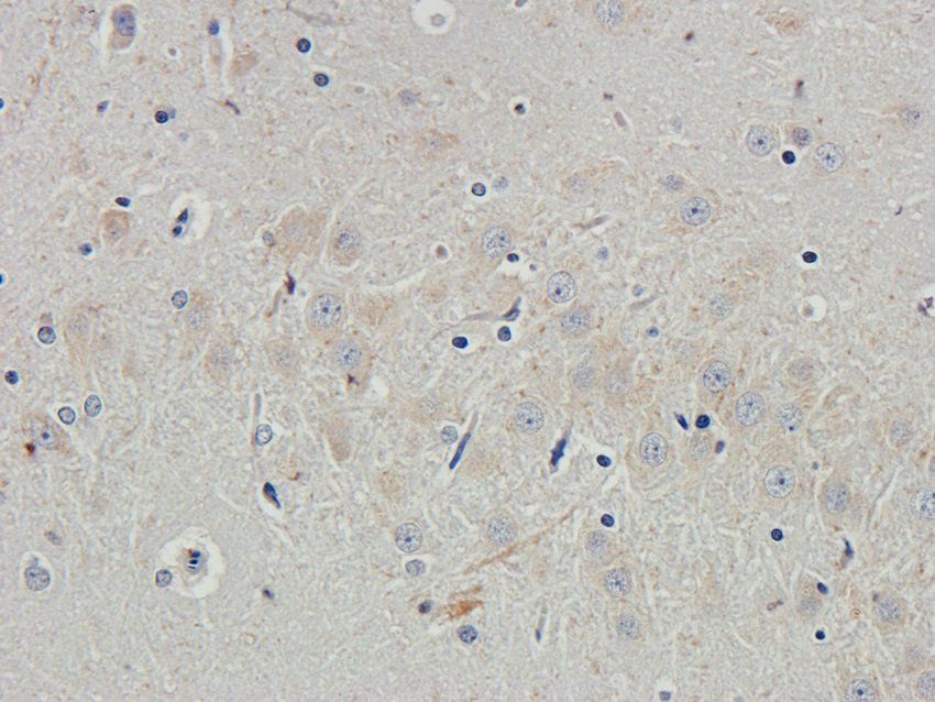 TGN46 Rabbit Polyclonal Antibody