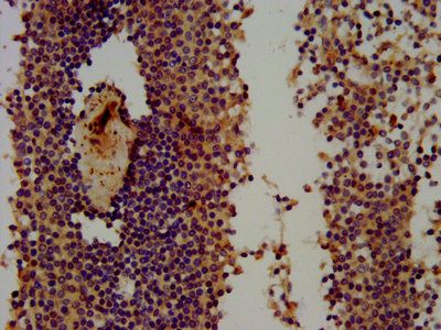 THEMIS Antibody