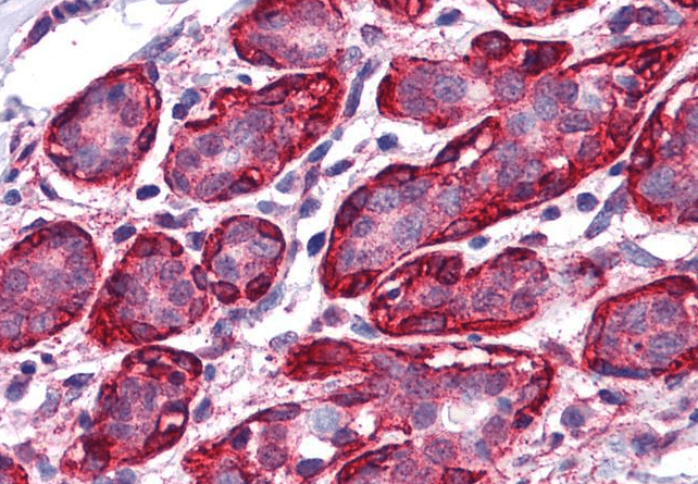 THRA Antibody