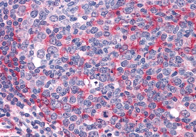 THRA Antibody