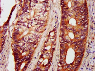 PAK4 Antibody