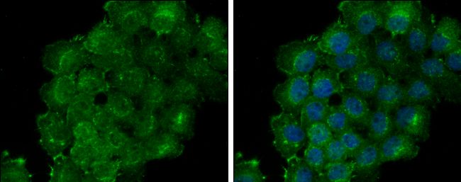 Thrombomodulin Rabbit Polyclonal Antibody