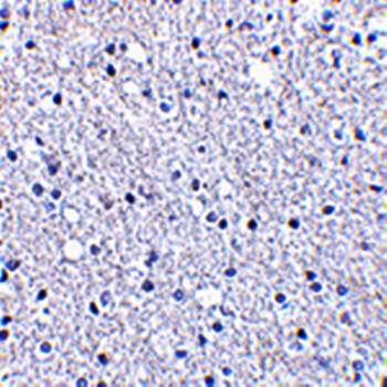 TIGAR Rabbit Polyclonal Antibody