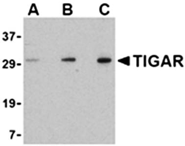 TIGAR Rabbit Polyclonal Antibody