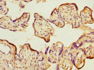 TIMM17A Antibody