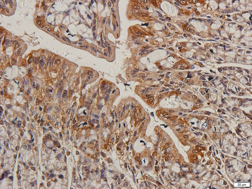 TIMP1 Rabbit Polyclonal Antibody