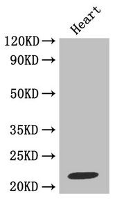 TIMP1 Antibody