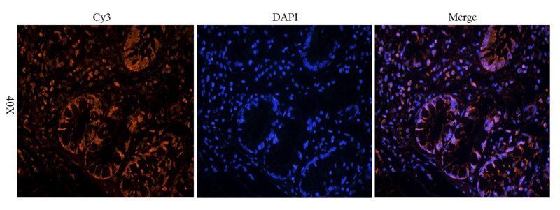 TIMP1 Rabbit Polyclonal Antibody
