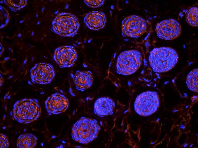 TIMP1 Rabbit Polyclonal Antibody
