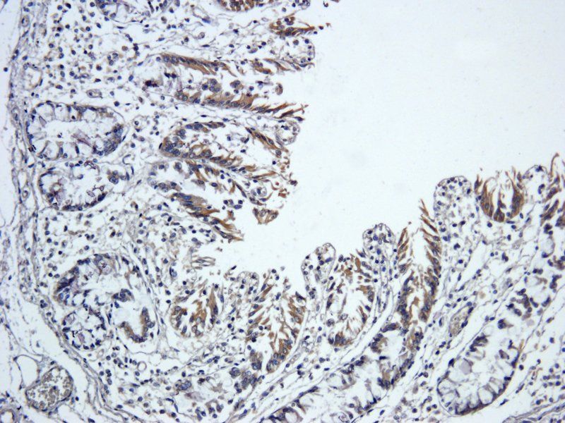 TIMP1 Rabbit Polyclonal Antibody