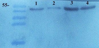 TIMP1 Rabbit Polyclonal Antibody