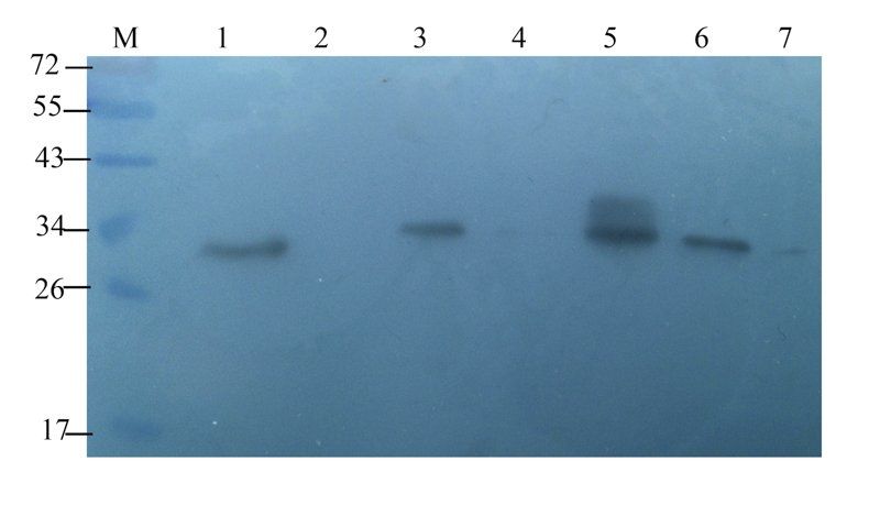 TIMP1 Rabbit Polyclonal Antibody