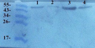 TIMP1 Rabbit Polyclonal Antibody