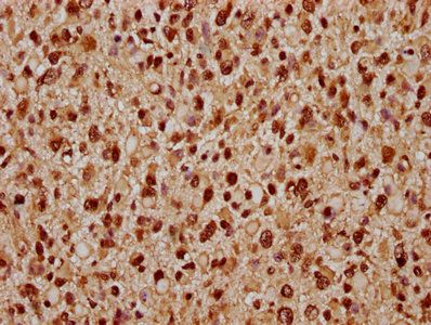 TIPARP Antibody