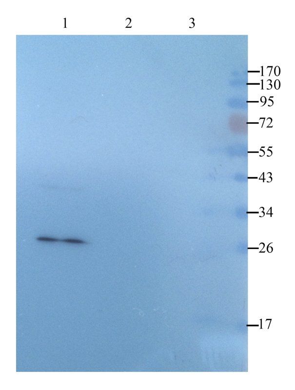 Tissue Factor Rabbit Polyclonal Antibody