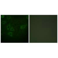 TK1 Antibody