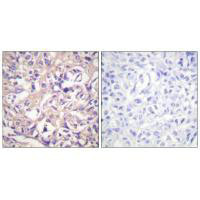 TK1 Antibody
