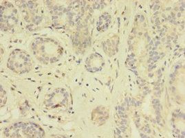 TK1 Antibody