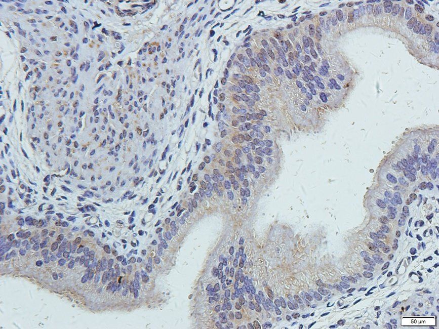 TKTL1 Rabbit Polyclonal Antibody