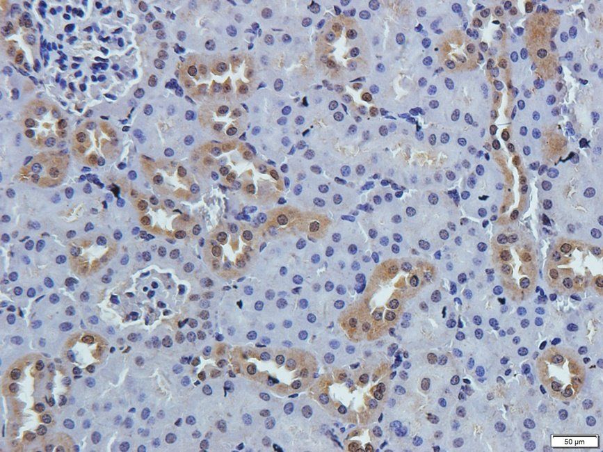 TKTL1 Rabbit Polyclonal Antibody