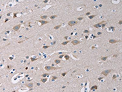 TLR1 Antibody