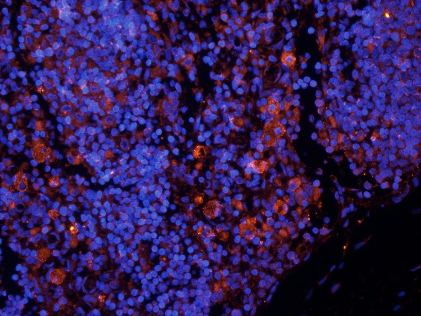 TLR2 Rabbit Polyclonal Antibody