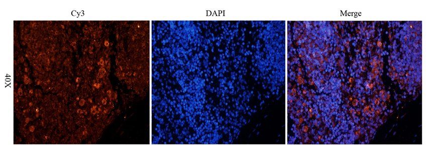 TLR2 Rabbit Polyclonal Antibody