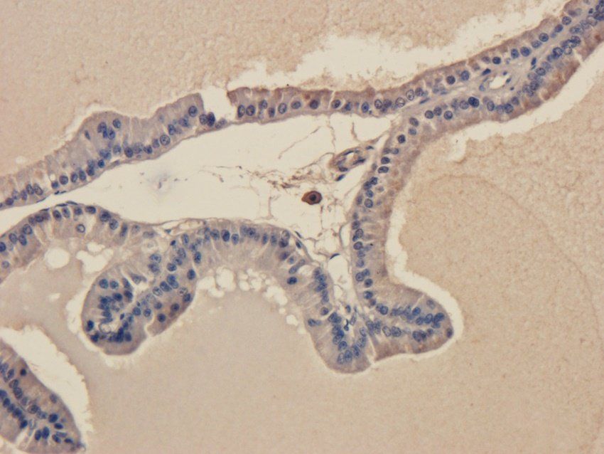 TLR2 Rabbit Polyclonal Antibody
