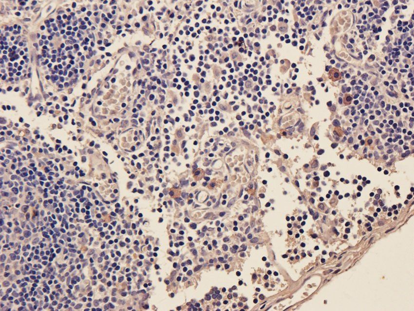 TLR2 Rabbit Polyclonal Antibody