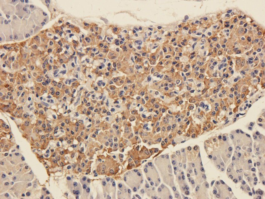 TLR2 Rabbit Polyclonal Antibody