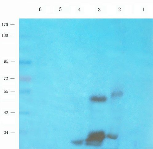 TLR2 Rabbit Polyclonal Antibody