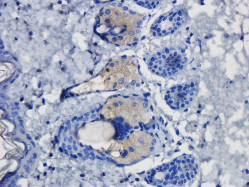 TLR2 Rabbit Polyclonal Antibody