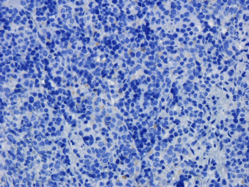 TLR2 Rabbit Polyclonal Antibody