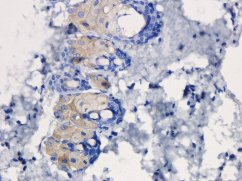 TLR2 Rabbit Polyclonal Antibody