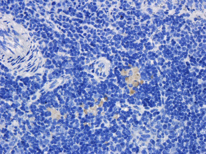 TLR2 Rabbit Polyclonal Antibody