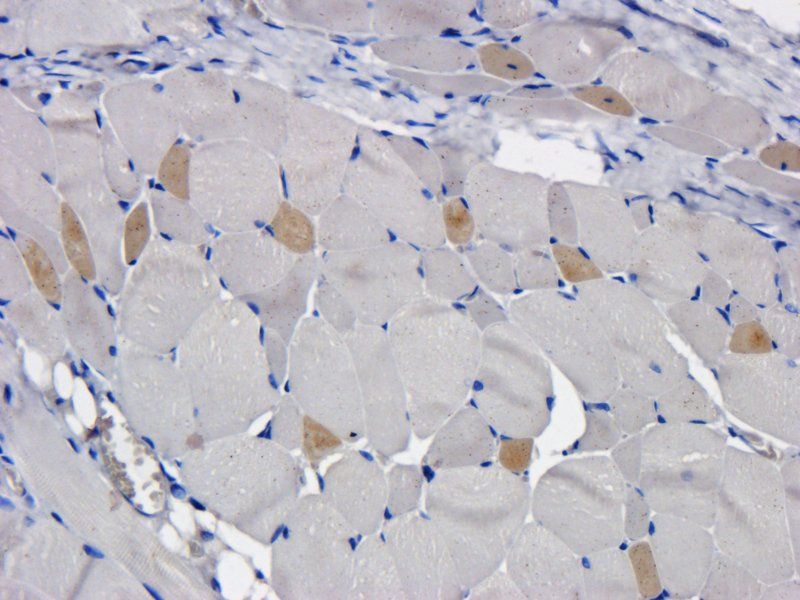 TLR2 Rabbit Polyclonal Antibody