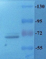 TLR2 Rabbit Polyclonal Antibody