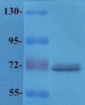 TLR2 Rabbit Polyclonal Antibody