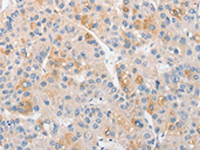 TLR4 Antibody