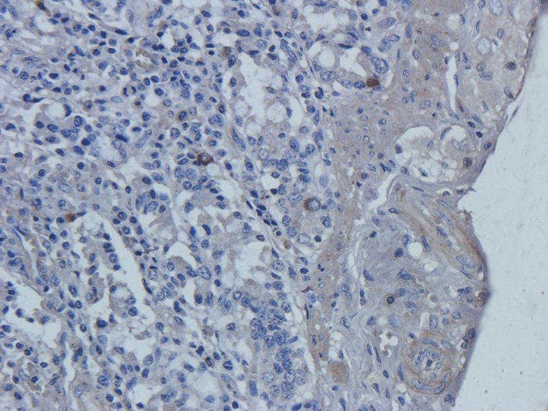 TLR4 Rabbit Polyclonal Antibody