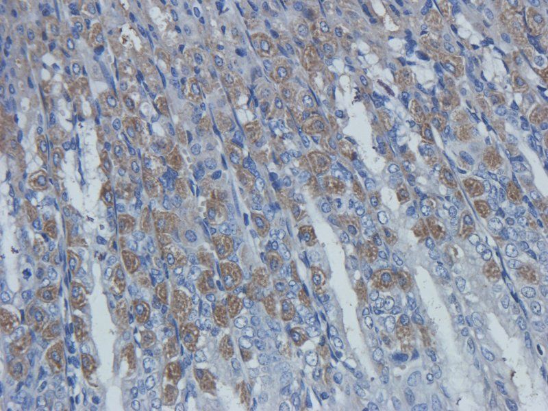 TLR4 Rabbit Polyclonal Antibody